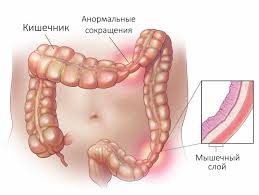 Психосоматика кишечника