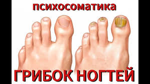 Психосоматика грибка ногтей