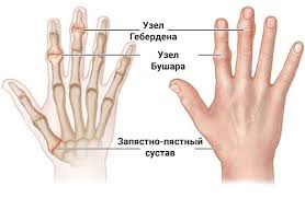 Психосоматика Перелом пальца