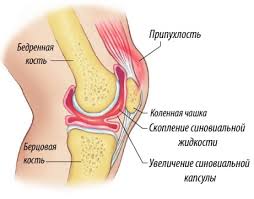 Психосоматика Синовит