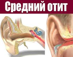 Психосоматика среднего отита