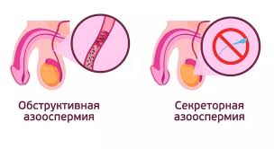 Психосоматика Азооспермия
