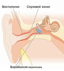 Психосоматика Наружного Отита