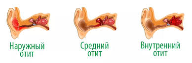 Психосоматика Отит
