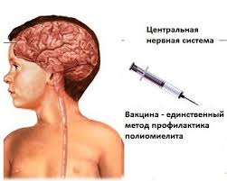 Психосоматика Полиомиелита