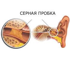 Психосоматика Серной пробки