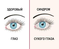 Психосоматика Синдрома Сухого Глаза