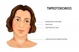 Психосоматика Тиреотоксикоза