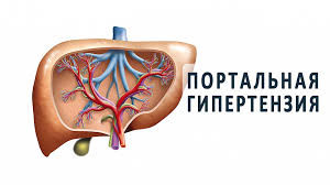 Психосоматика Портальная гипертензия