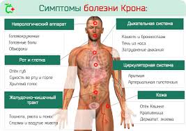Психосоматика Болезни Крона