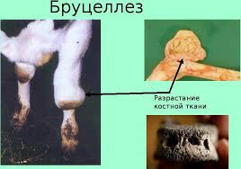 Психосоматика Бруцеллеза
