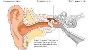 Психосоматика Тугоухость (глухота)