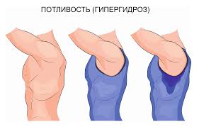 Психосоматика гипергидроза (потливость)