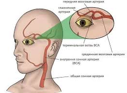 Психосоматика глазной мигрени