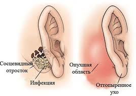 Психосоматика гнойного отита