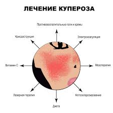 Психосоматика Купероз