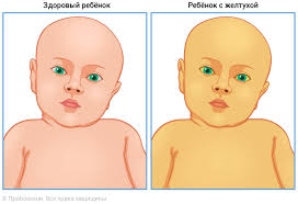 Психосоматика Желтуха